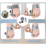 ToeRelief Pro - 50% OFF while stock lasts!