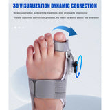 ToeRelief Pro - 50% OFF while stock lasts!